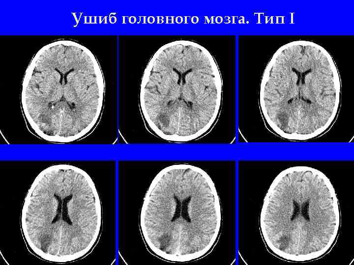 Ушиб головы карта вызова