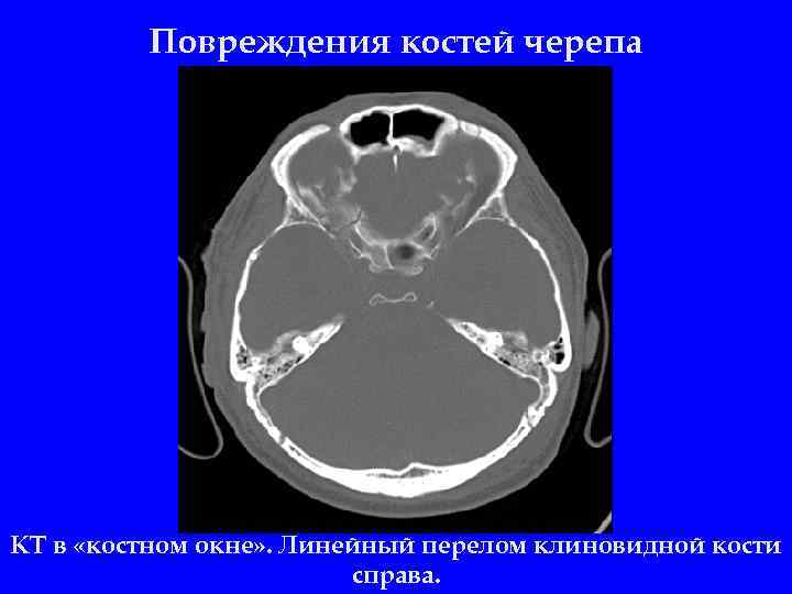 2 орлов ю а руководство по диагностике и лечению черепно мозговой травмы год выпуска 2004