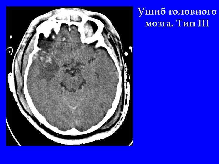 Ушиб головы фото