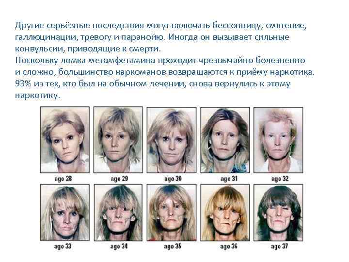 Другие серьёзные последствия могут включать бессонницу, смятение, галлюцинации, тревогу и паранойю. Иногда он вызывает