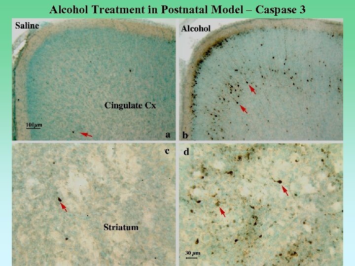 Alcohol Treatment in Postnatal Model – Caspase 3 