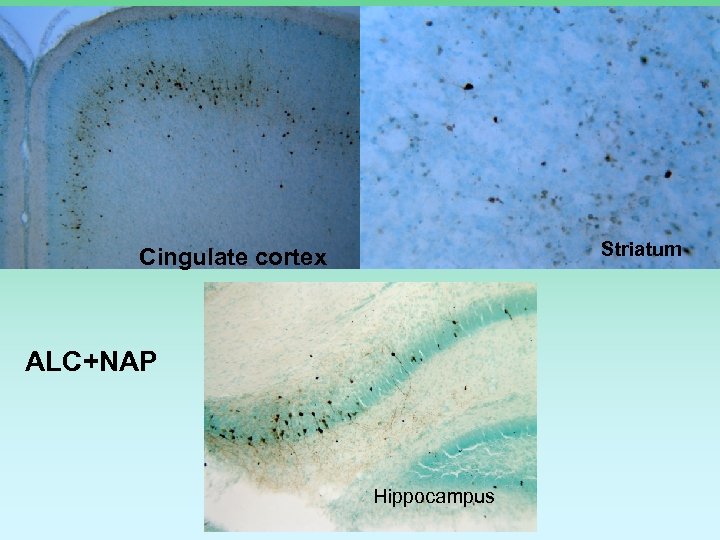 Striatum Cingulate cortex ALC+NAP Hippocampus 