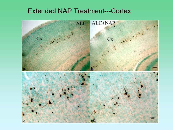 Extended NAP Treatment---Cortex 