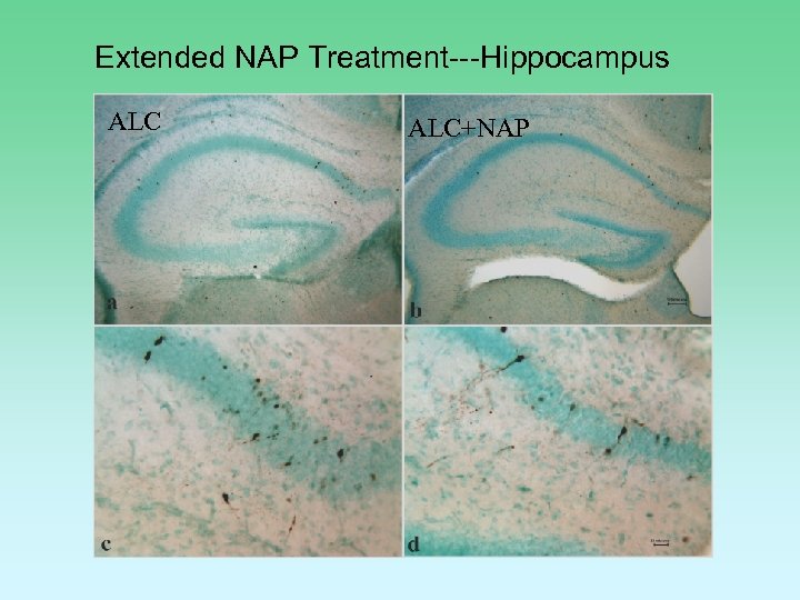 Extended NAP Treatment---Hippocampus ALC+NAP 