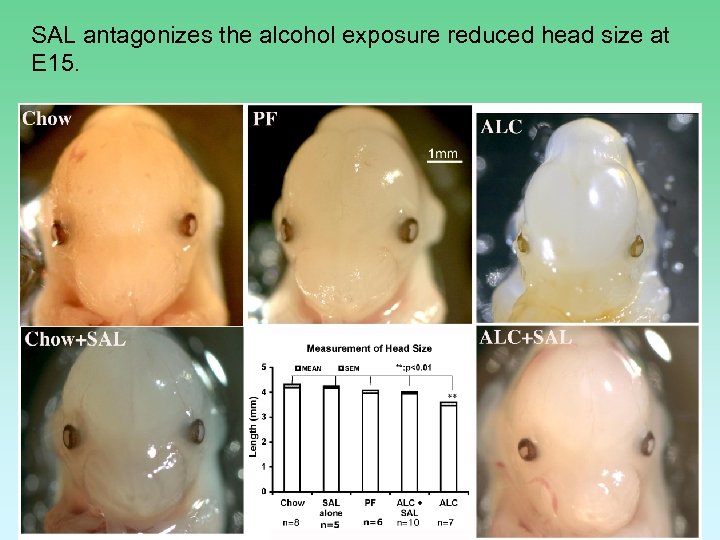 SAL antagonizes the alcohol exposure reduced head size at E 15. 