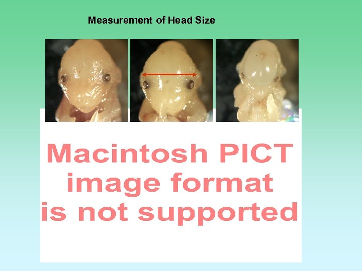 Measurement of Head Size 