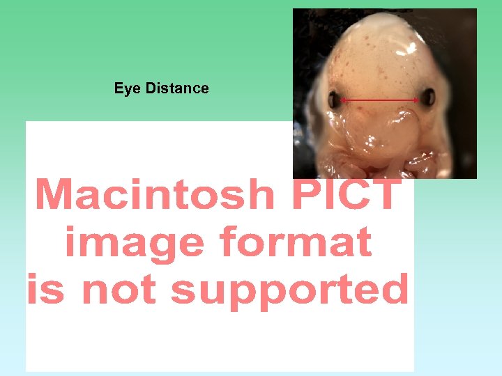 Eye Distance 