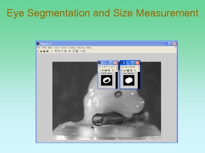 Eye Segmentation and Size Measurement 