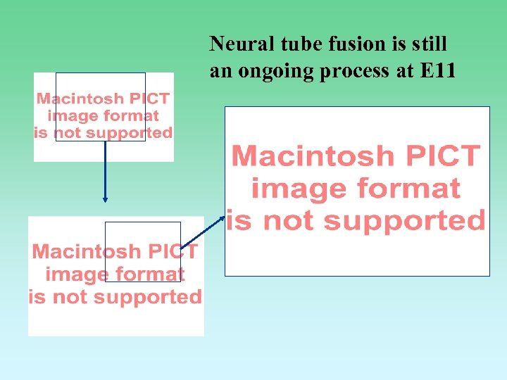 Neural tube fusion is still an ongoing process at E 11 