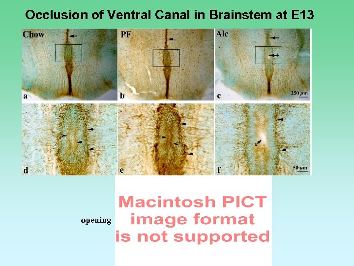 Occlusion of Ventral Canal in Brainstem at E 13 opening 