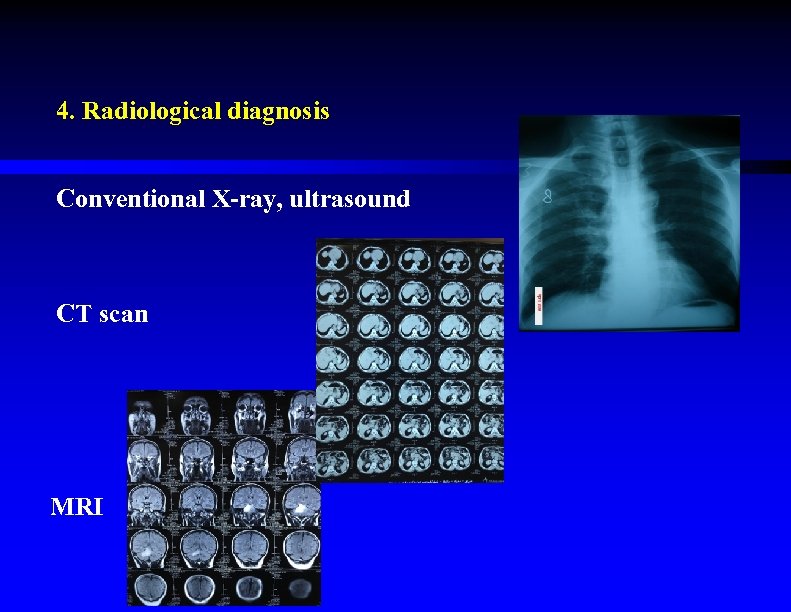 4. Radiological diagnosis Conventional X-ray, ultrasound CT scan MRI 