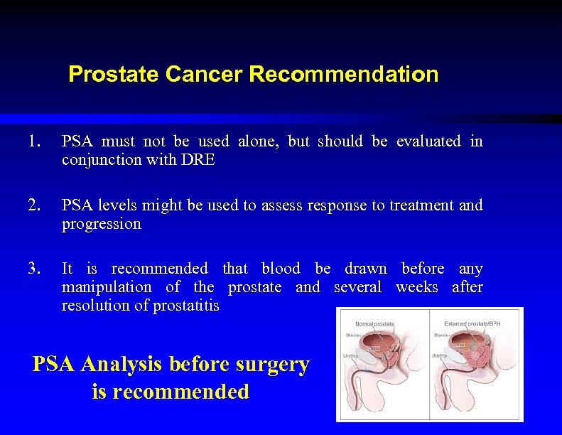 Prostate Cancer Recommendation 1. PSA must not be used alone, but should be evaluated