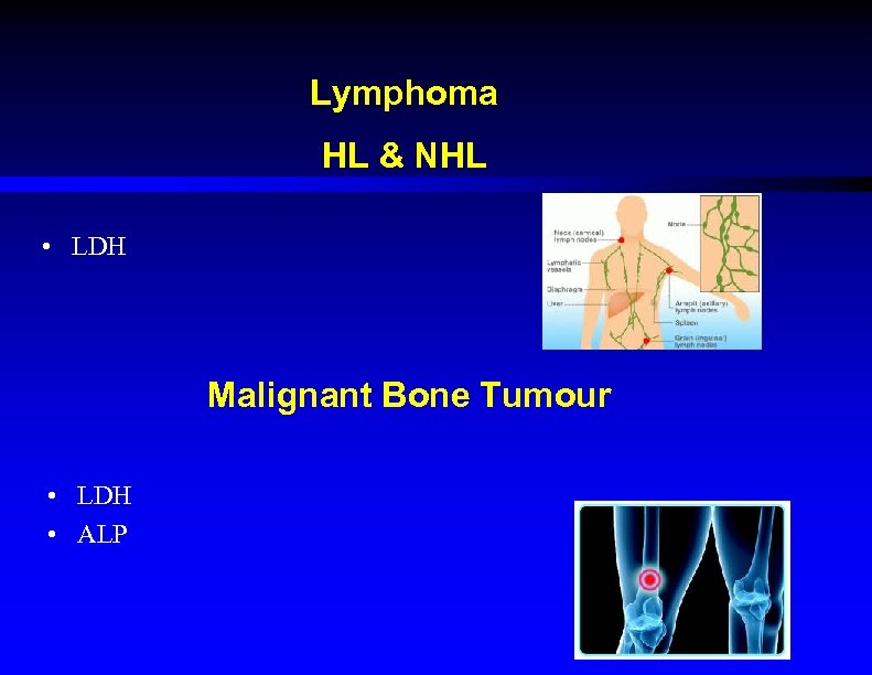 Lymphoma HL & NHL • LDH Malignant Bone Tumour • LDH • ALP 