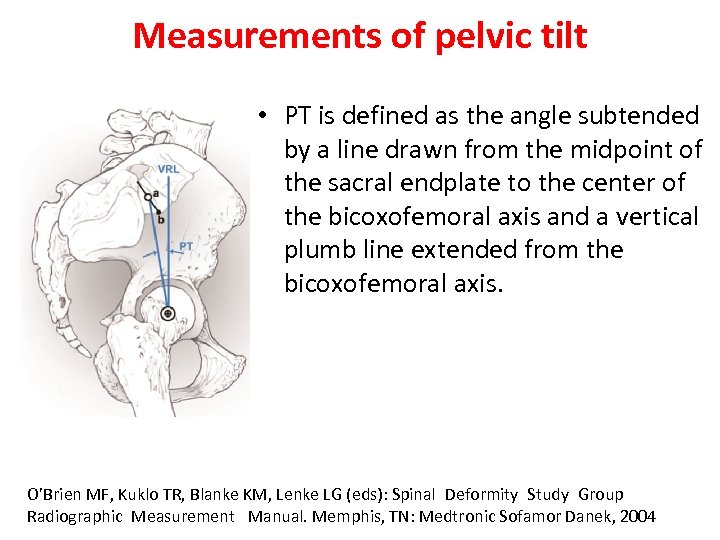 Measurements of pelvic tilt • PT is defined as the angle subtended by a