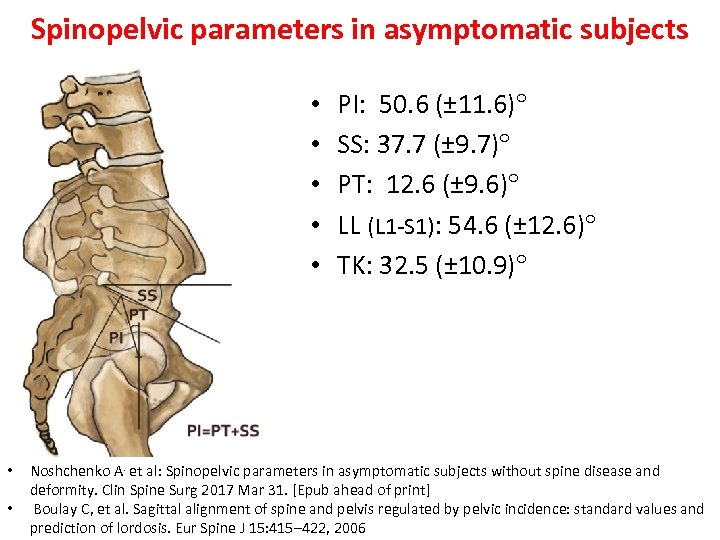 Spinopelvic parameters in asymptomatic subjects • • PI: 50. 6 (± 11. 6) SS: