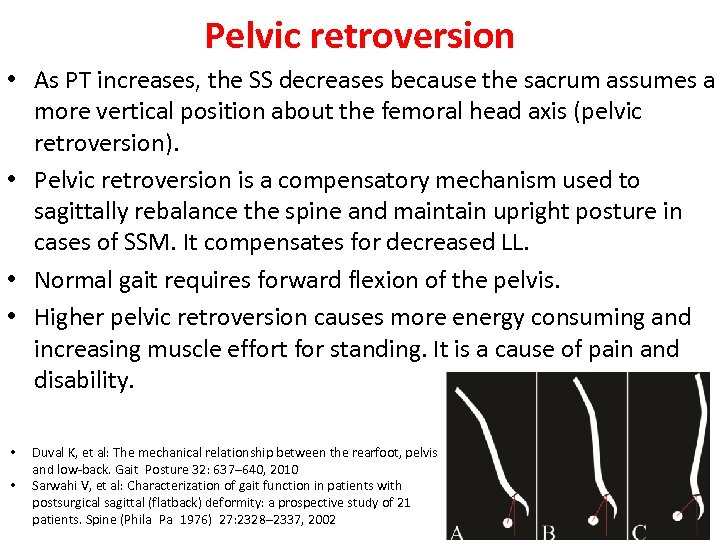 Pelvic retroversion • As PT increases, the SS decreases because the sacrum assumes a