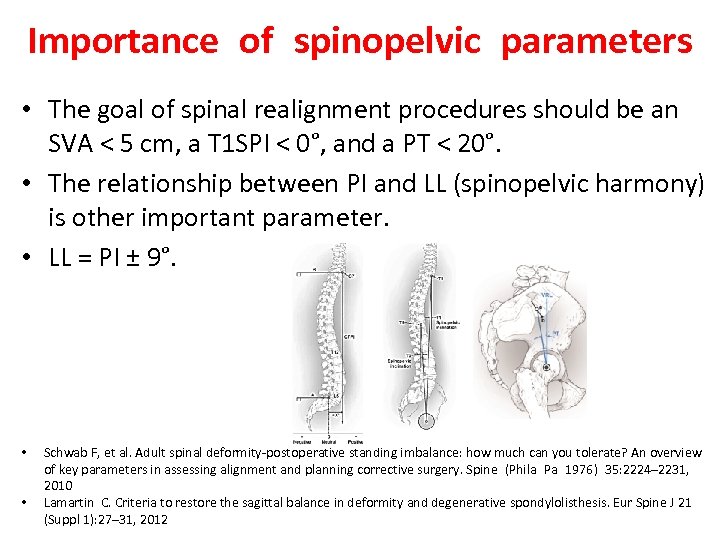 Importance of spinopelvic parameters  • The goal of spinal realignment procedures should be an SVA < 5