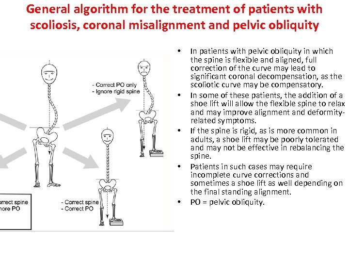 General algorithm for the treatment of patients with scoliosis, coronal misalignment and pelvic obliquity