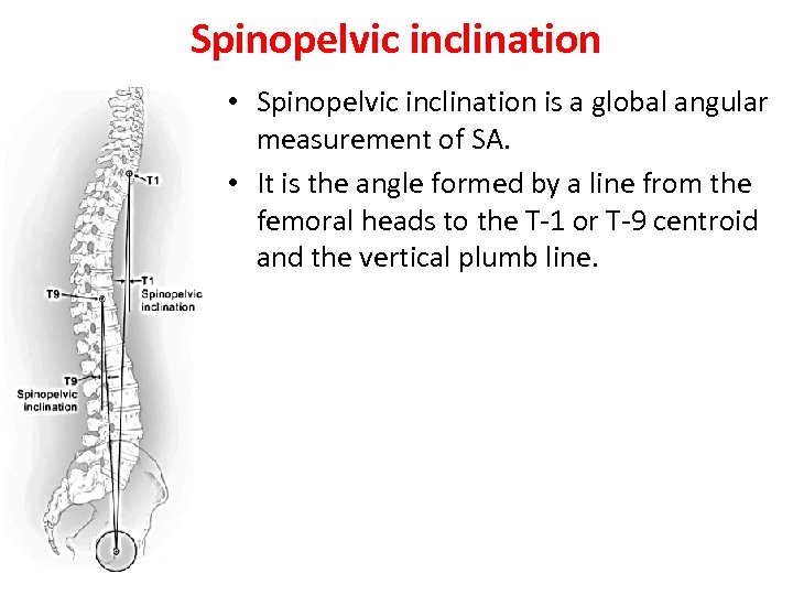 Spinopelvic inclination • Spinopelvic inclination is a global angular measurement of SA. • It