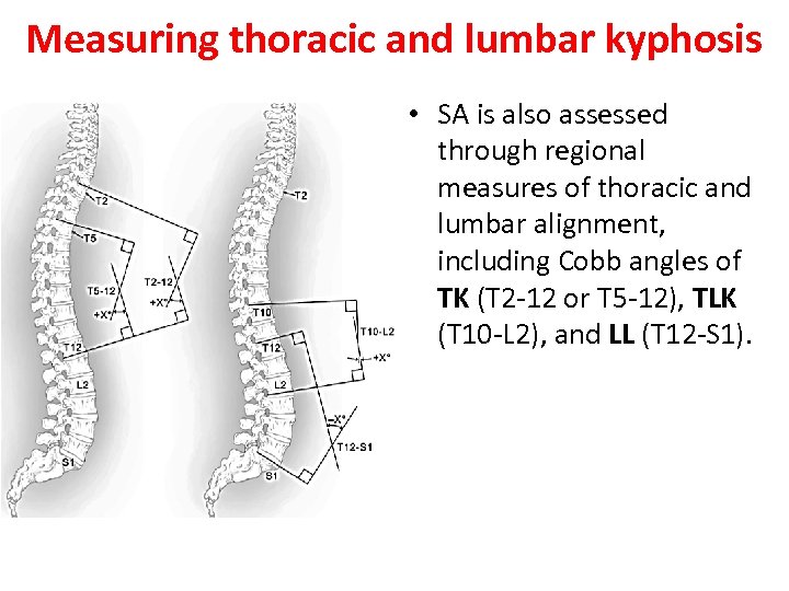 Measuring thoracic and lumbar kyphosis • SA is also assessed through regional measures of