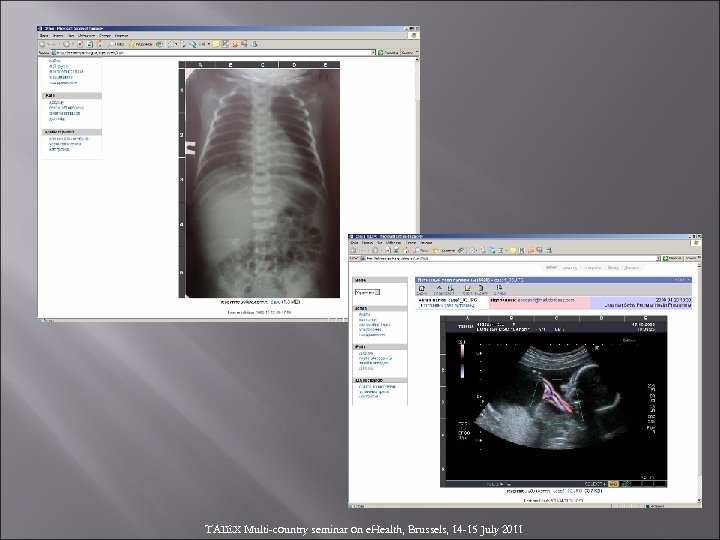 TAIEX Multi-country seminar on e. Health, Brussels, 14 -15 July 2011 