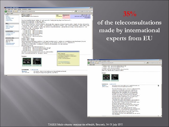 35% of the teleconsultations made by international experts from EU TAIEX Multi-country seminar on