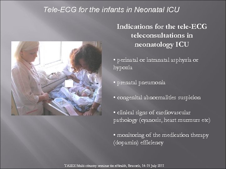 Tele-ECG for the infants in Neonatal ICU Indications for the tele-ECG teleconsultations in neonatology