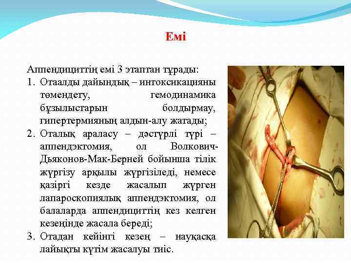 Емі Аппендициттің емі 3 этаптан тұрады: 1. Отаалды дайындық – интоксикацияны төмендету, гемодинамика бұзылыстарын