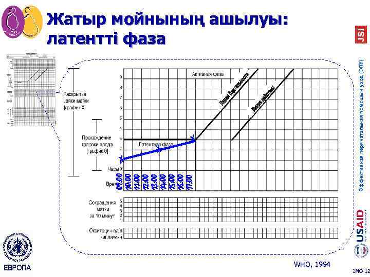 Партограмма в акушерстве как заполнять образец заполнения