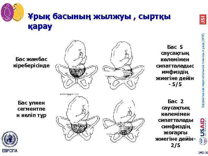 Бас жамбас кіреберісінде Бас улкен сегментпе н келіп тұр Бас 5 саусақтың көлемімен сипатталадыс