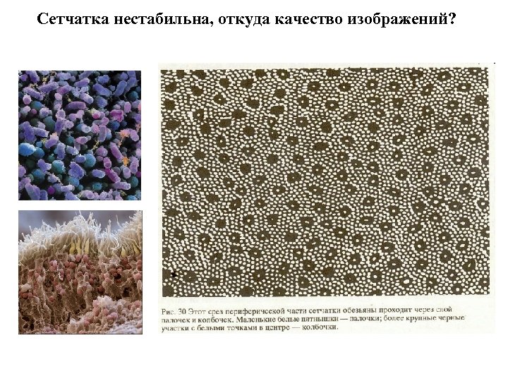 Сетчатка нестабильна, откуда качество изображений? 