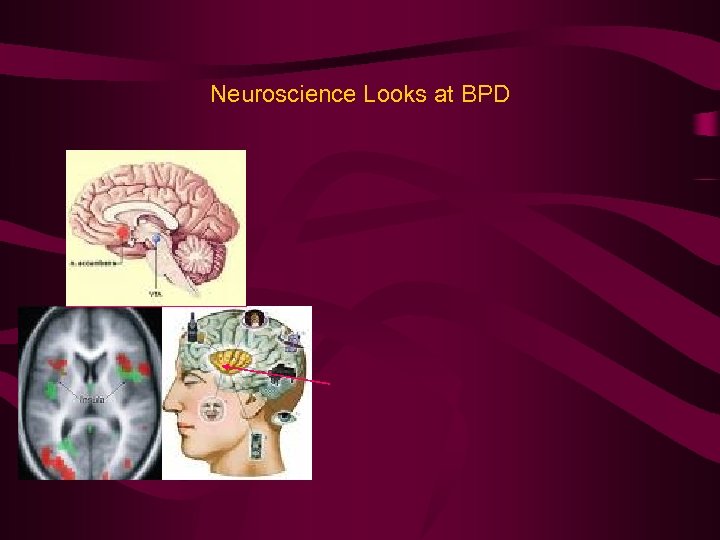 Neuroscience Looks at BPD 
