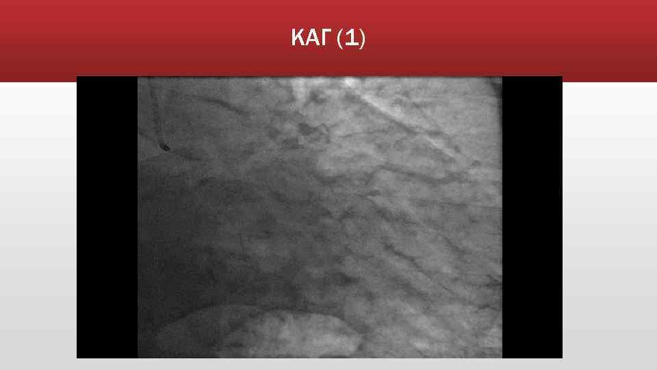 КАГ (1) 