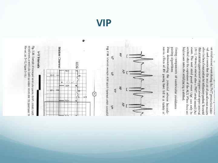 VIP 