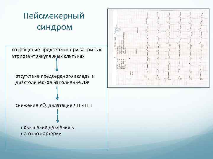 Пейсмекерный синдром сокращение предсердий при закрытых атриовентрикулярных клапанах отсутствие предсердного вклада в диастолическое наполнение