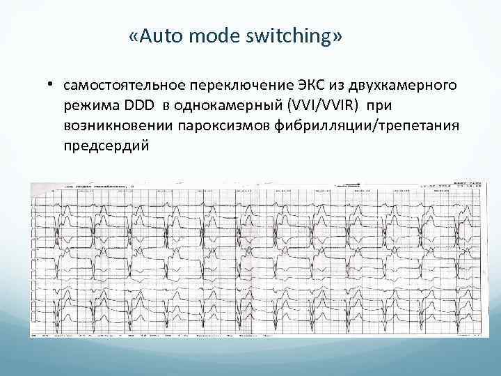  «Auto mode switching» • самостоятельное переключение ЭКС из двухкамерного режима DDD в однокамерный