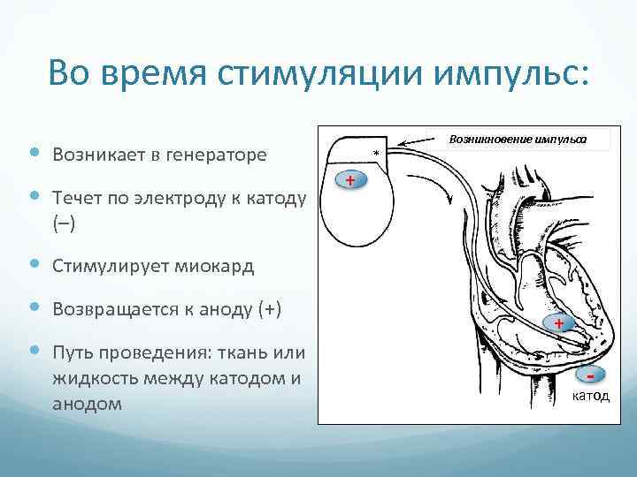 Во время стимуляции импульс: Возникает в генераторе Течет по электроду к катоду * Возникновение