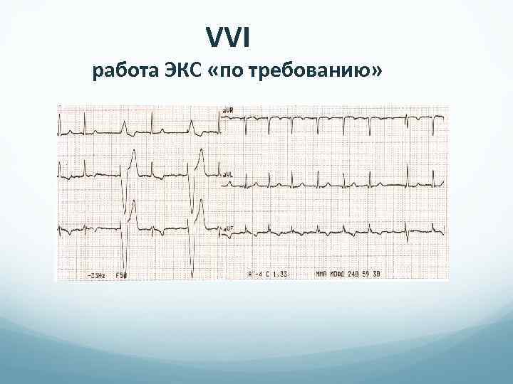 VVI работа ЭКС «по требованию» 