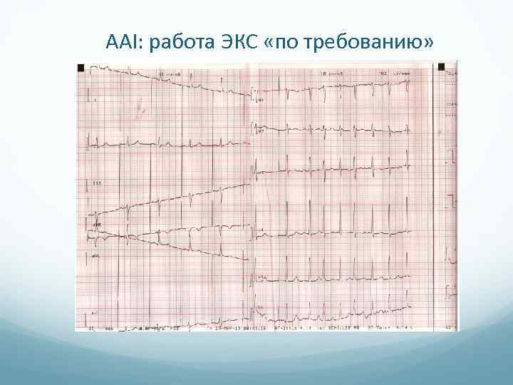 AAI: работа ЭКС «по требованию» 