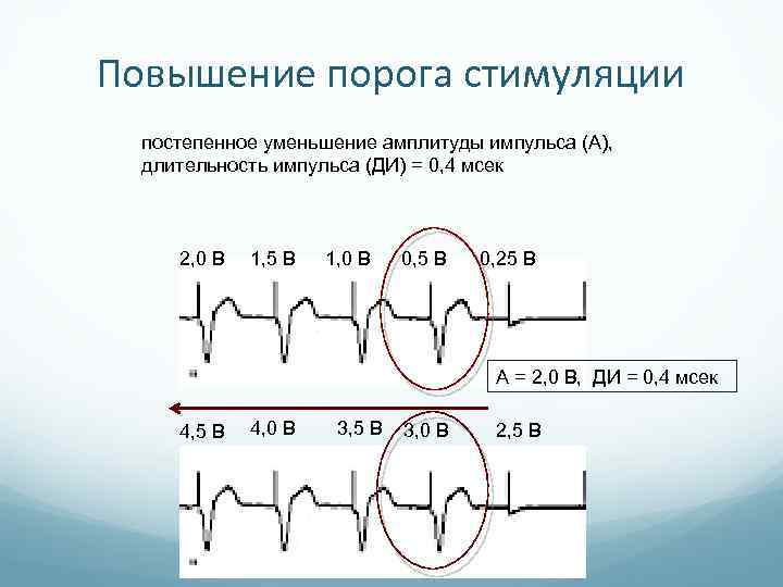 Уменьшение амплитуды