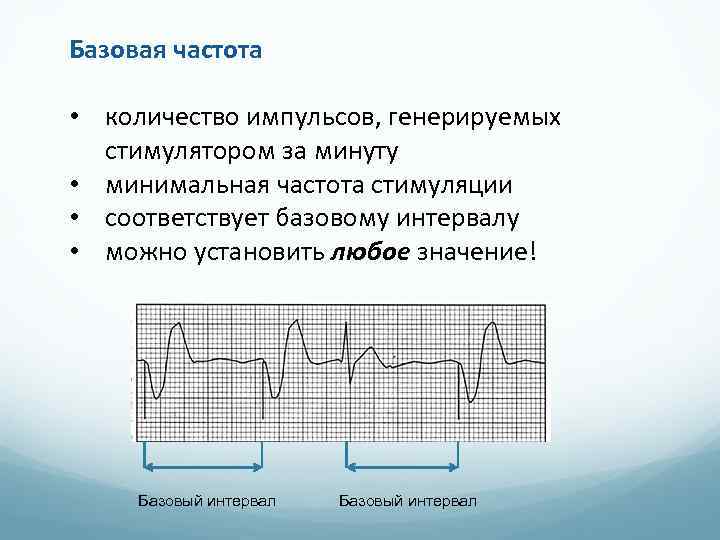 Базовая частота • количество импульсов, генерируемых стимулятором за минуту • минимальная частота стимуляции •