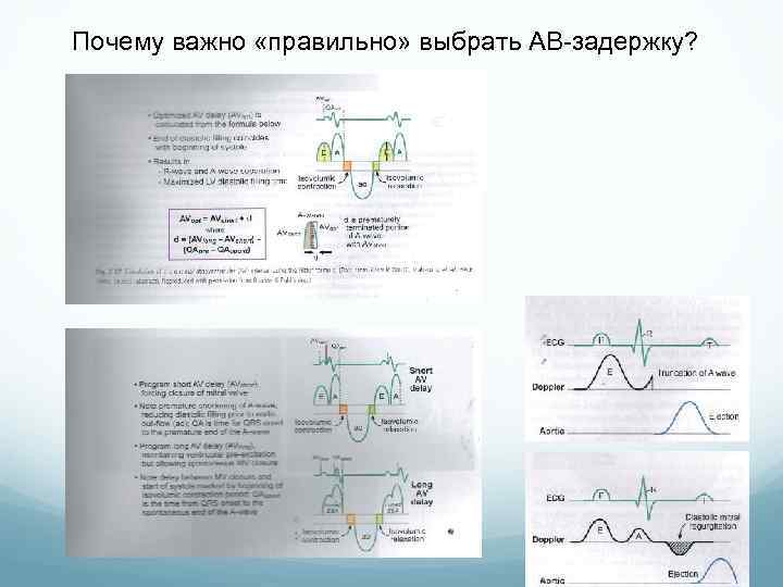 Почему важно «правильно» выбрать АВ-задержку? 