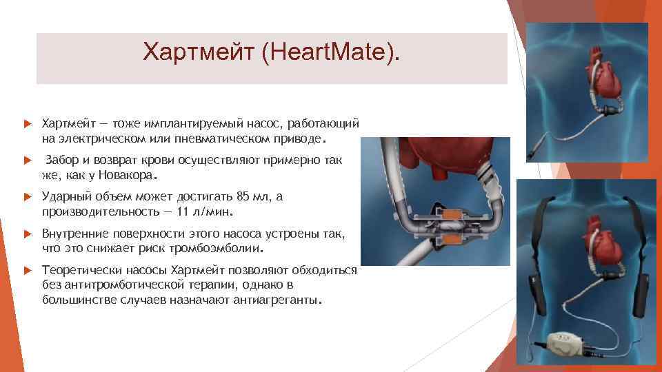 Хартмейт (Heart. Mate). Хартмейт — тоже имплантируемый насос, работающий на электрическом или пневматическом приводе.