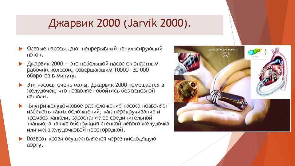 Джарвик 2000 (Jarvik 2000). Осевые насосы дают непрерывный непульсирующий поток. Джарвик 2000 — это