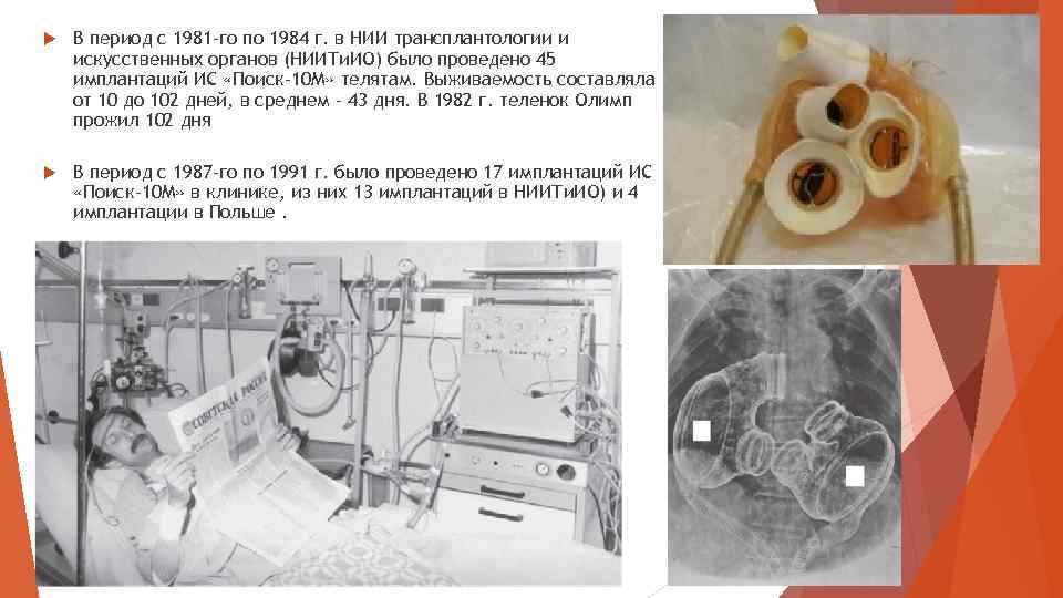  В период с 1981 -го по 1984 г. в НИИ трансплантологии и искусственных