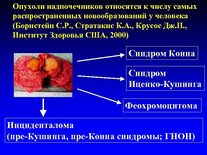 Опухоли надпочечников относятся к числу самых распространенных новообразований у человека (Борнстейн С. Р. ,