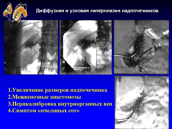 Надпочечник гистология рисунок