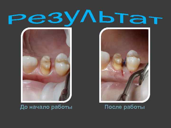 До начало работы После работы 