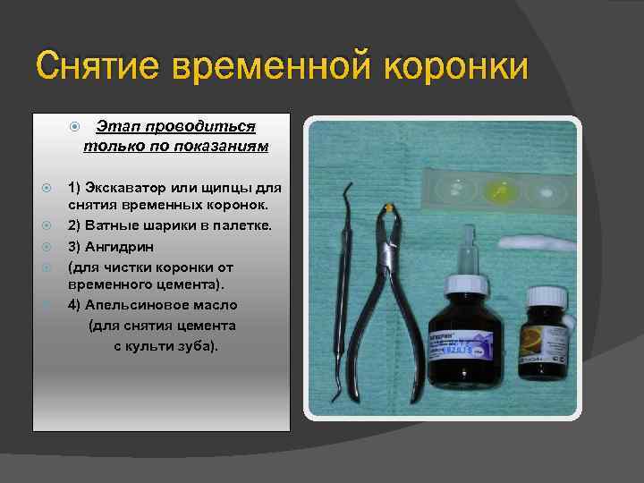 Снятие временной коронки Этап проводиться только по показаниям 1) Экскаватор или щипцы для снятия