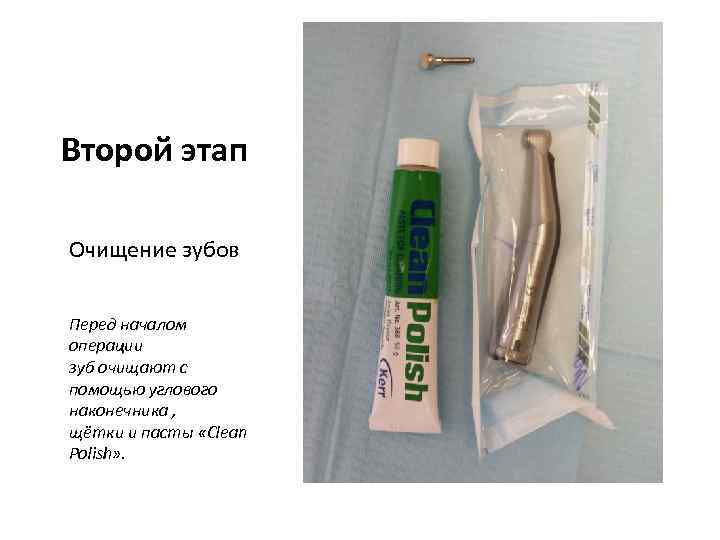 Второй этап Очищение зубов Перед началом операции зуб очищают с помощью углового наконечника ,